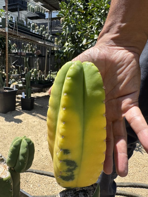 Variegated Vitiligo - Image 12